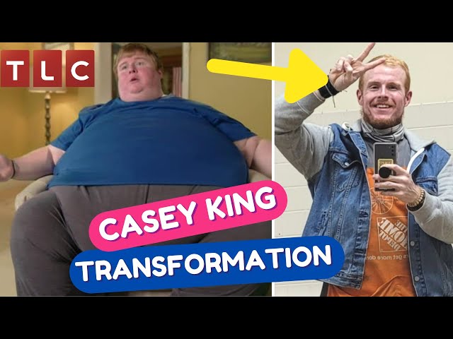 Casey King Weight Loss: A Dramatic Journey of Shedding Over 600 Pounds!