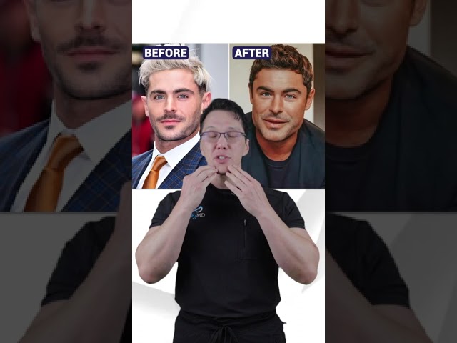 Zac Efron Face Transformation: Unraveling the Truth Behind His Looks in 2024