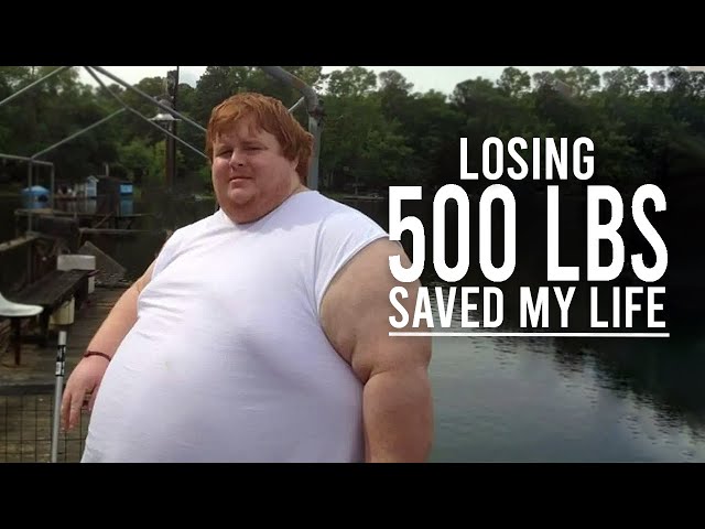 Casey King Weight Loss: An Incredible Transformation of 600 Pounds Lost in 4 Years