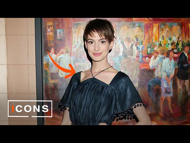 Anne Hathaway's Weight Loss Transformation: 25 Pounds in 2 Weeks for Les Misérables!