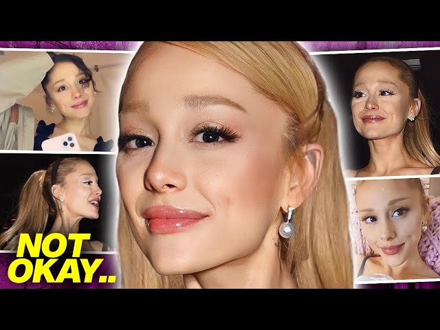 Ariana Grande Weight Loss: Shocking Transformation and Health Concerns in 2024