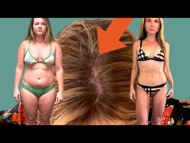 Ozempic Weight Loss Before and After: Real Transformations in 3 Months