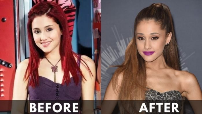 Ariana Grande's Weight Loss: The Inside Story Behind Her Stunning Transformation